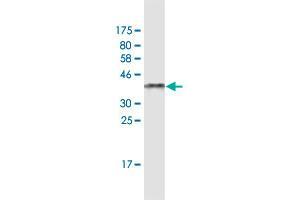 Western Blot detection against Immunogen (38. (C17orf37 抗体  (AA 1-115))