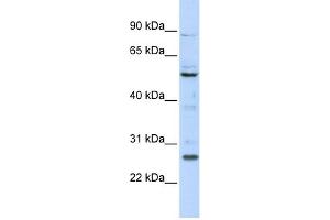 WB Suggested Anti-HOXC5 Antibody Titration:  0. (Homeobox C5 抗体  (N-Term))