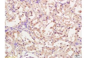 Formalin-fixed and paraffin embedded rat kidney tissue labeled with Anti-CPT1A Polyclonal Antibody, Unconjugated (ABIN677018) at 1:200, followed by conjugation to the secondary antibody and DAB staining (CPT1A 抗体  (AA 1-100))