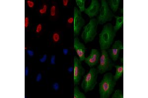 ABIN6261257 and ABIN6277502 staining  cells by IF/ICC. (DDX5 抗体  (C-Term))