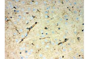 Immunohistochemistry (IHC) image for anti-Peroxiredoxin 1 (PRDX1) (AA 100-128), (Middle Region) antibody (ABIN3043903)