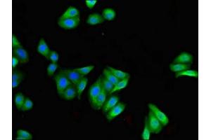 Immunofluorescent analysis of HepG2 cells using ABIN7152948 at dilution of 1:100 and Alexa Fluor 488-congugated AffiniPure Goat Anti-Rabbit IgG(H+L) (FILIP1 抗体  (AA 957-1192))