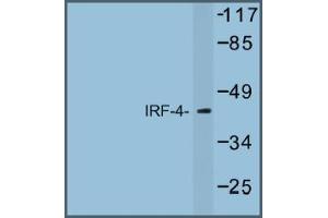 Image no. 1 for anti-Interferon Regulatory Factor 4 (IRF4) antibody (ABIN317672) (IRF4 抗体)