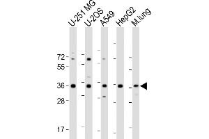 All lanes : Anti-RCN3 Antibody (Center) at 1:2000 dilution Lane 1: U-251 MG whole cell lysate Lane 2: U-2OS whole cell lysate Lane 3: A549 whole cell lysate Lane 4: HepG2 whole cell lysate Lane 5: Mouse lung lysate Lysates/proteins at 20 μg per lane.