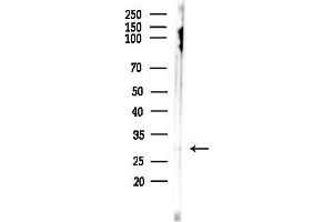 Western blot analysis of lysates from HepG2 cells(starvation,24h treatment), using Neutrophil Elastase Antibody at 1/1000 dilution.