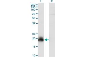 Western Blot analysis of HAND2 expression in transfected 293T cell line by HAND2 monoclonal antibody (M09), clone 2C10. (HAND2 抗体  (AA 135-216))
