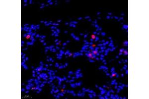Immunofluorescence (Paraffin-embedded Sections) (IF (p)) image for anti-SIX Homeobox 1 (SIX1) antibody (ABIN7075617)