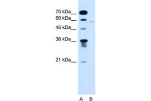 Western Blotting (WB) image for anti-Flavin Containing Monooxygenase 3 (FMO3) antibody (ABIN2462820) (FMO3 抗体)
