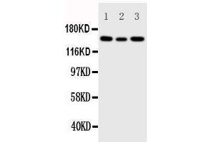 Anti-IGF1 Receptor antibody, Western blotting Lane 1: 293T Cell Lysate Lane 2: A549 Cell Lysate Lane 3: MCF-7 Cell Lysate (IGF1R 抗体  (C-Term))