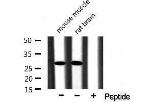 Western blot analysis of extracts of various samples,using CKLF2 Antibody. (CKLF 抗体)