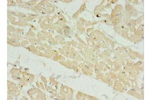 Immunohistochemistry of paraffin-embedded human heart tissue using ABIN7165422 at dilution of 1:100 (FAM156A 抗体  (AA 1-153))