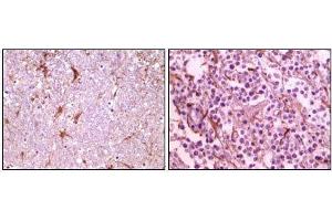 Immunohistochemical analysis of paraffin-embedded human thalamus (left) and glioma (right) tissue, showing membrane localization using CIB1 mouse mAb with DAB staining. (CIB1 抗体)