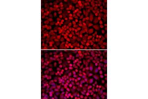 Immunofluorescence analysis of U2OS cells using NCOA1 antibody (ABIN5970476). (NCOA1 抗体)