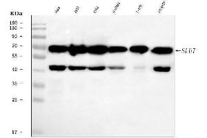 Western blot analysis of SLU7 using anti-SLU7 antibody (ABIN7601697).