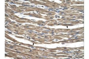 Immunohistochemistry (IHC) image for anti-Chromosome 21 Open Reading Frame 33 (C21orf33) (N-Term) antibody (ABIN2782372) (C21orf33 抗体  (N-Term))