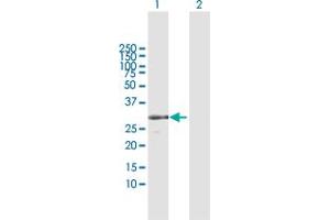 Western Blot analysis of RPA4 expression in transfected 293T cell line by RPA4 MaxPab polyclonal antibody. (RPA4 抗体  (AA 1-261))