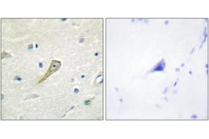Immunohistochemistry analysis of paraffin-embedded human brain tissue, using SEMA4A Antibody. (Sema4a 抗体  (AA 501-550))