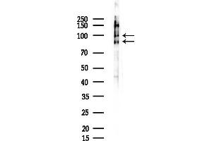 Western blot analysis of lysates from Mouse testis, using Phospho-Progesterone Receptor (Ser400) Antibody at 1/1000 dilution.