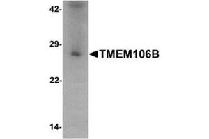 Western blot analysis of TMEM106B in human liver tissue lysate with TMEM106B antibody at 1 ug/mL. (TMEM106B 抗体  (N-Term))