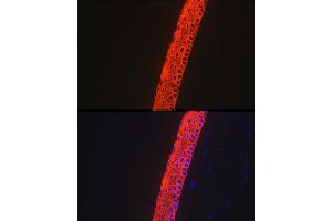 Immunofluorescence analysis of Mouse eye using Cytokeratin 12 (KRT12) antibody (ABIN7268087) at dilution of 1:100. (KRT12 抗体)
