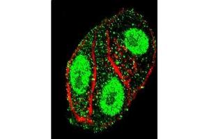 Confocal Immunofluorescent analysis of SFTPC Antibody (N-term) Cat. (Surfactant Protein C 抗体  (N-Term))