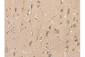Immunohistochemistry (IHC) image for anti-Solute Carrier Family 6 (Neurotransmitter Transporter, Creatine), Member 8 (SLC6A8) antibody (ABIN7192520)