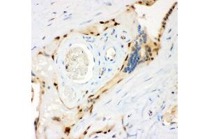 Immunohistochemistry (IHC) image for anti-Ribosomal Protein S6 Kinase, 90kDa, Polypeptide 5 (RPS6KA5) (AA 540-665) antibody (ABIN3043424)