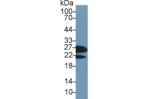 Detection of RBP4 in Mouse Serum using Polyclonal Antibody to Retinol Binding Protein 4 (RBP4)
