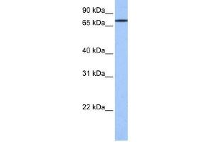 WB Suggested Anti-GK2 Antibody Titration: 0. (GK2 抗体  (C-Term))