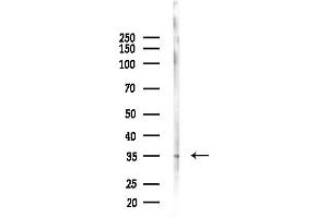 anti-Intelectin 1 (Galactofuranose Binding) (ITLN1) (C-Term) antibody