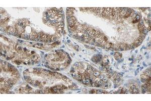 ABIN6273991 at 1/100 staining Human prostate tissue by IHC-P. (TUBA4A 抗体  (N-Term))