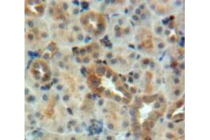 Used in DAB staining on fromalin fixed paraffin-embedded Kidney tissue (BMP7 抗体  (AA 30-431))