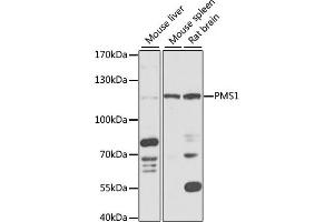 Western blot analysis of extracts of various cell lines, using PMS1 antibody (ABIN6128473, ABIN6145826, ABIN6145827 and ABIN6218265) at 1:1000 dilution. (PMS1 抗体  (AA 405-619))