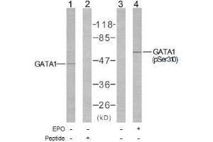Image no. 1 for anti-GATA Binding Protein 1 (Globin Transcription Factor 1) (GATA1) (Ser310) antibody (ABIN197170) (GATA1 抗体  (Ser310))