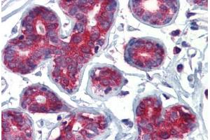 Human Breast (formalin-fixed, paraffin-embedded) stained with TAL1 antibody ABIN462261 followed by biotinylated goat anti-rabbit IgG secondary antibody ABIN481713, alkaline phosphatase-streptavidin and chromogen. (TAL1 抗体  (C-Term))