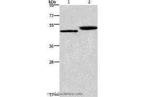 Western blot analysis of Human stomach cancer and mouse stomach tissue, using CTSE Polyclonal Antibody at dilution of 1:450 (Cathepsin E 抗体)