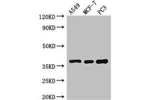 Western Blot Positive WB detected in: A549 whole cell lysate, MCF-7 whole cell lysate, PC-3 whole cell lysate All lanes: SLC9A3R2 antibody at 3 μg/mL Secondary Goat polyclonal to rabbit IgG at 1/50000 dilution Predicted band size: 38, 37, 25 kDa Observed band size: 38 kDa (SLC9A3R2 抗体  (AA 106-313))