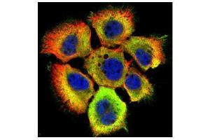 Immunofluorescence (IF) image for anti-Heat Shock 70kDa Protein 1A (HSPA1A) (Center) antibody (ABIN2856787)