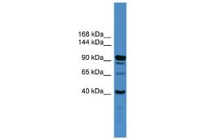 WB Suggested Anti-IFT88 Antibody Titration: 0. (IFT88 抗体  (Middle Region))