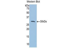 Western Blotting (WB) image for anti-VAMP (Vesicle-Associated Membrane Protein)-Associated Protein A, 33kDa (VAPA) (AA 1-249) antibody (ABIN1078660) (VAPA 抗体  (AA 1-249))