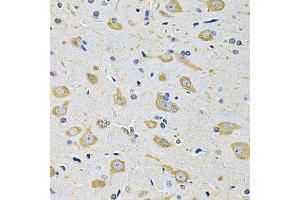 Immunohistochemistry of paraffin-embedded mouse brain using FASTKD1 Antibody. (FASTKD1 抗体  (AA 638-847))