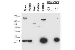 Western blot using  anti-SelW antibody shows detection of endogenous SelW in mouse brain, muscle and testes lysates. (Selenoprotein W 抗体)