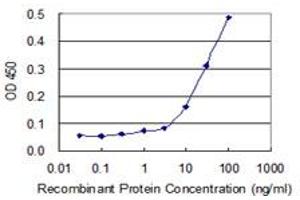 Detection limit for recombinant GST tagged AUH is 3 ng/ml as a capture antibody. (AUH 抗体  (AA 44-135))