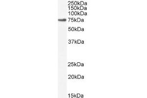 Western Blotting (WB) image for anti-Mitogen-Activated Protein Kinase Kinase Kinase 7 (MAP3K7) (Internal Region) antibody (ABIN185640)