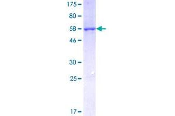 CBR1 Protein (AA 1-277) (GST tag)