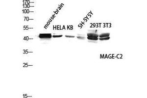 Western Blot (WB) analysis of Mouse Brain HeLa KB SH-SY5Y 293T 3T3 lysis using MAGE-C2 antibody. (MAGEC2 抗体  (Internal Region))