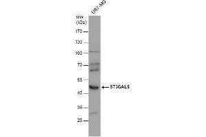 WB Image ST3GAL5 antibody detects ST3GAL5 protein by western blot analysis. (ST3GAL5 抗体)