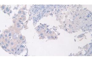 Immunohistochemistry (IHC) image for anti-Pantothenate Kinase 4 (PANK4) (AA 639-773) antibody (ABIN7436114)