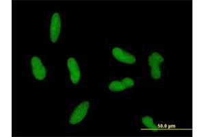 Immunofluorescence (IF) image for anti-Zinc Finger Protein 461 (ZNF461) (AA 1-563) antibody (ABIN530095)