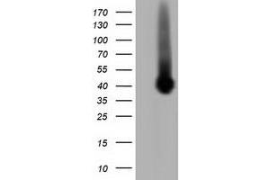 Western Blotting (WB) image for anti-Pleckstrin (PLEK) antibody (ABIN1500271) (Pleckstrin 抗体)